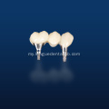 ဝက်အူထိန်းသိမ်းထားသွားဘက်ဆိုင်ရာ implant ပြန်လည်ထူထောင်ရေး